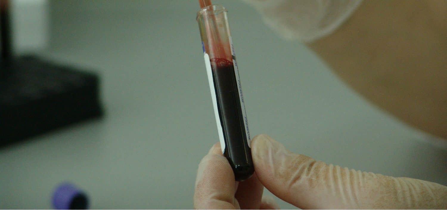 What is a vaccine titer test for dogs? What is a vaccine titer test for dogs?