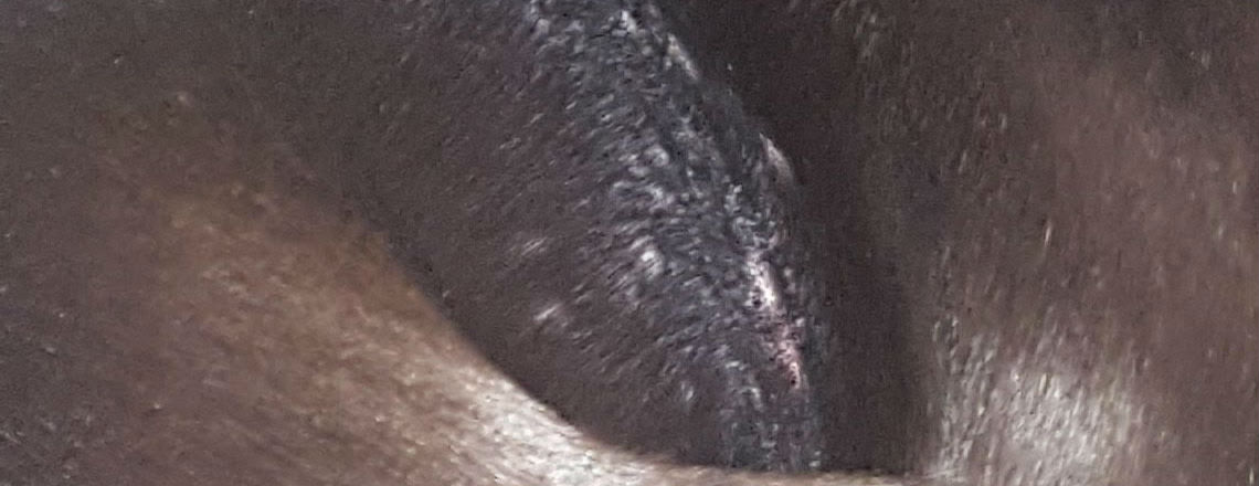 My dog has small bumps on his skin that are sore. What is the cause and treatment? My dog has small bumps on his skin that are sore. What is the cause and treatment?
