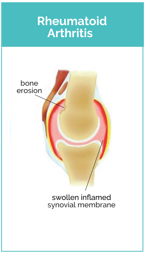 Rheumatoid Arthritis Dog Joint