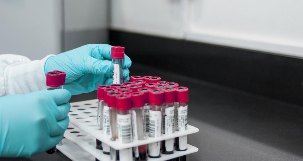 Test tubes with blood samples are being placed in a holder