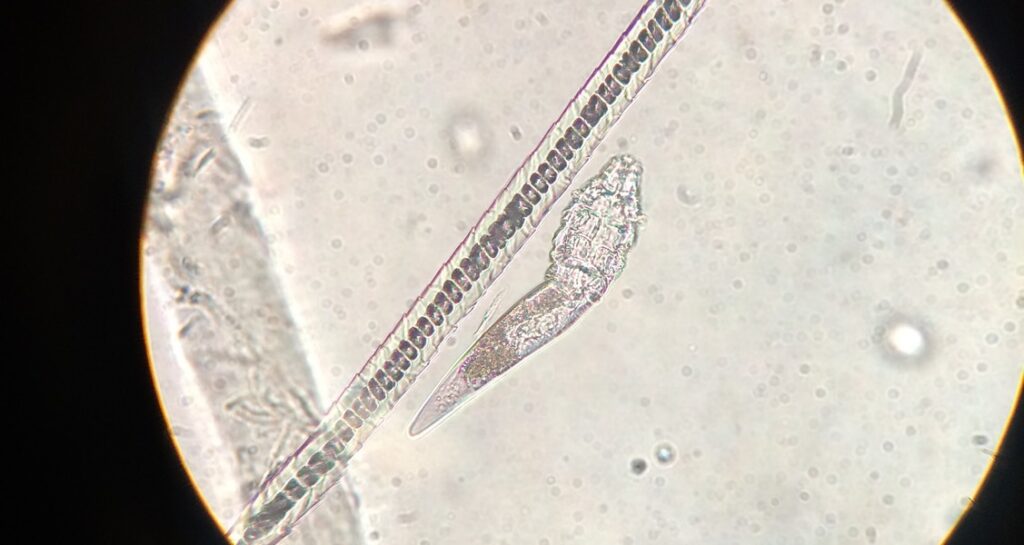 A parasite being viewed under a microscope