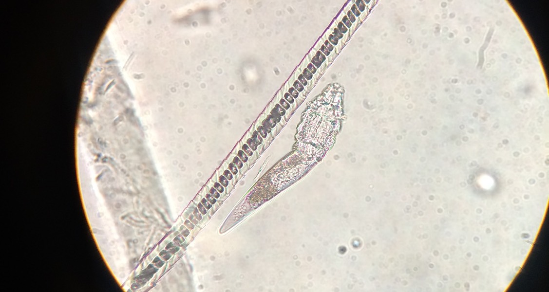 How molecular testing is reshaping the way parasites can be detected How molecular testing is reshaping the way parasites can be detected
