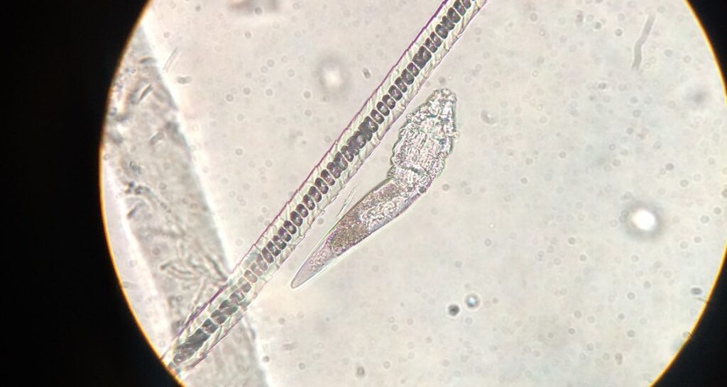 A microscopic image of a parasite